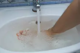 "סתימה בכיור לא מתחילה בבת אחת. לוקח לה זמן להתפתח"